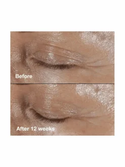 Smart Clinicial Repair Wrinkle Correcting Eye Cream -silmänympärysvoide 15 ml